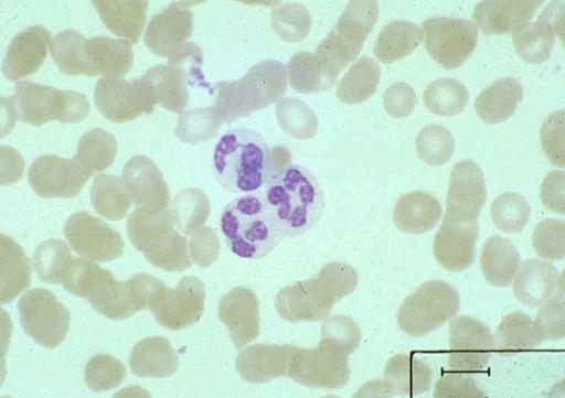 Granulocytes consist of: Neutrophils: - about 50-70% of blood leukocytes are neutrophils - have a multilobed nucleus and