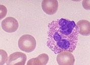 Eosinophils: - Somewhat phagocytic; Comprise - 3% of leukocytes - Thought to be important in