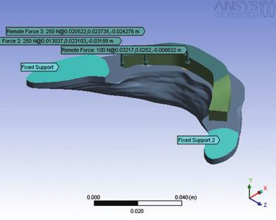 Meshed models A FEA of the models was carried out using ANSYS Workbench 11 software (ANSYS Inc, Canonsburg, USA).
