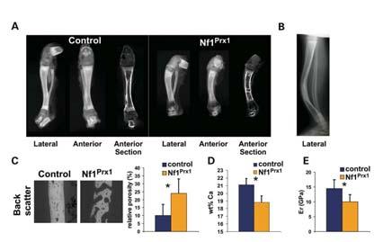 NF1 Mouse Models and Skeletal Development Australian group Schindeler/Little NF1 +/- mice treatment with BMP- 2/bisphosphonates Indiana group Yang/Clapp NF1 +/- mice with novel osteoclusto phenotype