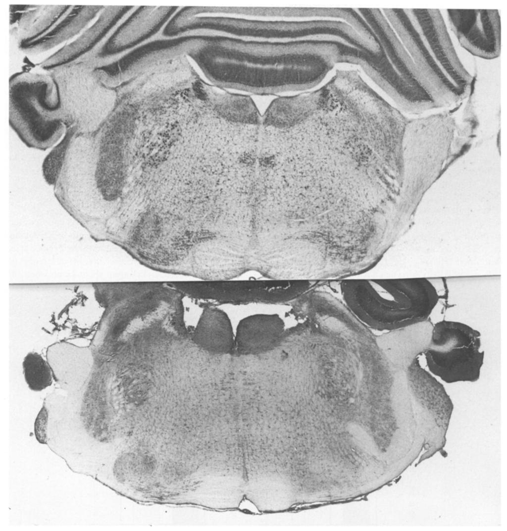 Animals in the full lesion group showed a 59, 52, 14, 43 and 13% depletion in norepinephrine in the cortex, hippocampus, hypothalamus, cerebellum and spinal cord, respectively, relative to the