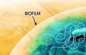 Biofilm makeup Biofilms are made up of a complex protective glycocalyx, produced by bacterial communities, which protects them