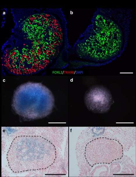 Supplementary Figure 10: Effects of in utero busulfan treatment on oocytes and the expression of Gli1 in the ovary. a-b, E18.