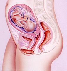 MATERNAL CONCERNS in Fontan Pregnancy SUPRAVENTRICULAR ARRHYTHMIAS 3-37% PREGNANCY RELATED BLEEDING 5-50% Post partum haemorrhage 14% HEART FAILURE 3-11% Decline in NYHA
