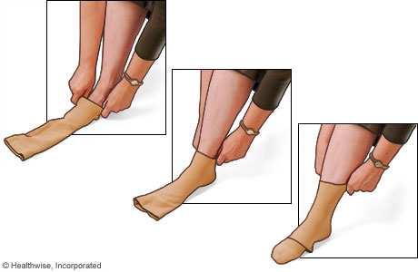 Grasp the hosiery at the top and pull out the fold. Repeat until the heel is in place.