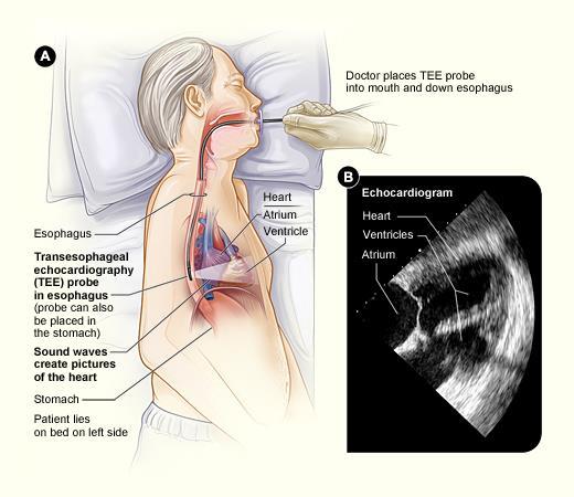 EKG) 27  Diagnostic Testing Echocardiogram