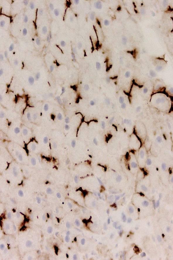 CD66a (biliary glycoprotein-1) CEA-like cell adhesion