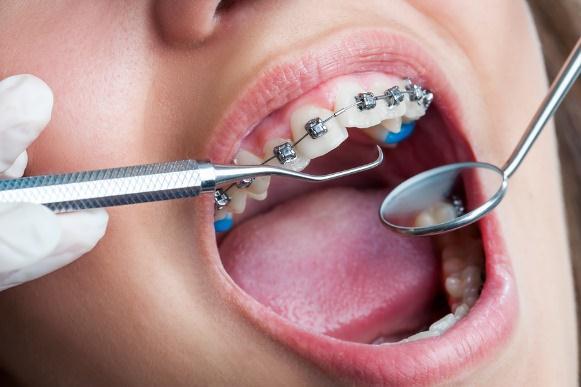 While all orthodontists are dentists, only about 6% of dentists go on to become orthodontists.