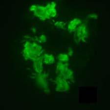 Immunofluorescence or Mass spectrometry Organ Sensitivity Abdominal fat