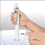 If Cuvitru remains in siliconized syringes for more than two hours, visible particles may form.