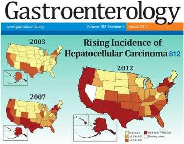 Hepatocellular Carcinoma (HCC) Common malignancy worldwide 5th most common cancer worldwide 2nd leading cause of cancer death ~600,000 deaths annually US incidence has more than tripled over the