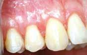 to the tooth roots and surgery zation of the
