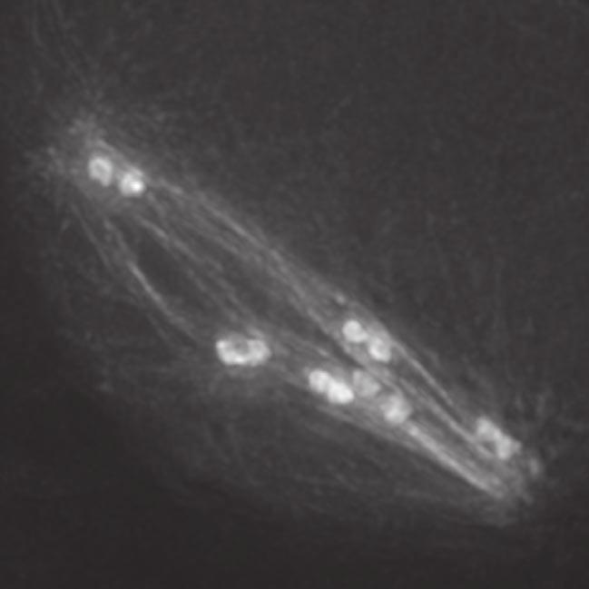 Images show GFP::tubulin and GFP::histone.