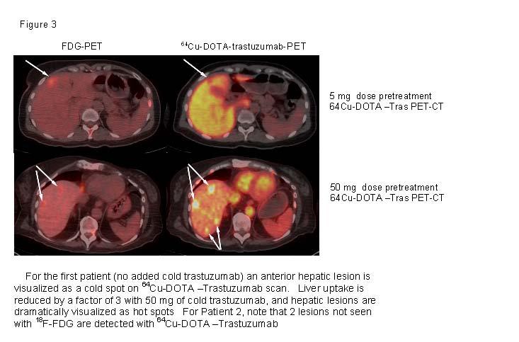 - Visualization of hepatic metastases is dramatically improved by pre-infusion of 50 mg of cold trastuzumab (Figure 3) Key Research Accomplishments: 1.