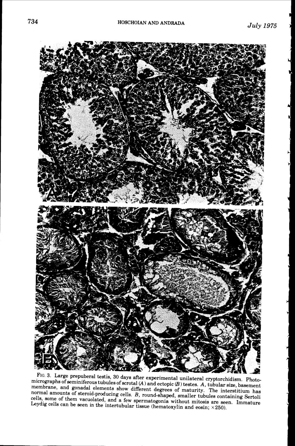 734 HOSCHOIAN AND ANDRADA July 1975 FIG. 3. Large prepuberal testis, 30 days after experimental unilateral cryptorchidism.