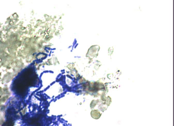 Rezultati mikroskopiranja ĉrevesne sluznice, ki je bila najprej obdelana tako, da smo