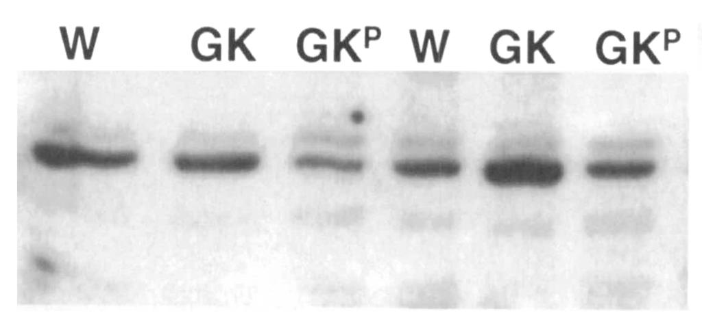 A representative autoradiograph is presented for Wistar (W; n = 6), GK (n = 6), and GK P (phlorizin-treated GK; n = 5). Relative molecular weights are indicated on the left.