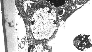 There was also some degeneration of pilaster cells. By 7 d after injection, however, these pathological changes were extensive (Fig. 1).