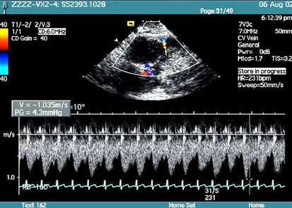 10 Establishing Better Standards of Care in Doppler Echocardiography, Computed Tomography and Nuclear Cardiology Fig. 9.