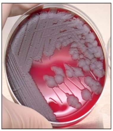 Laboratory Diagnostic Tests Culture : Nutrient broth motile non on blood agar plates, the organisms produce nonhemolytic gray to white