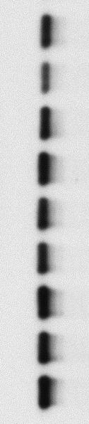 The internalized α2-mg was detected by immunoblot using an antibody against α2-mg (top blot).