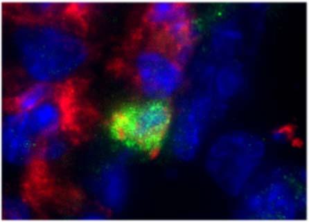 (green) colocalization with FP + (red) fibroblasts