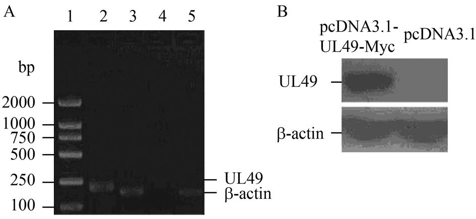 : DNA-EGS1386 P UL49 1693 UL49 mrna trna ( 3C) UL49 miniegs, UL49-miniEGS GGC GTG ( 3 E), UL49 mrna ( 3D) HSV-1 TK miniegs( TK-1), EGS ( 3F) 图 2 稳定表达 UL49 基因细胞系的建立 Fig.