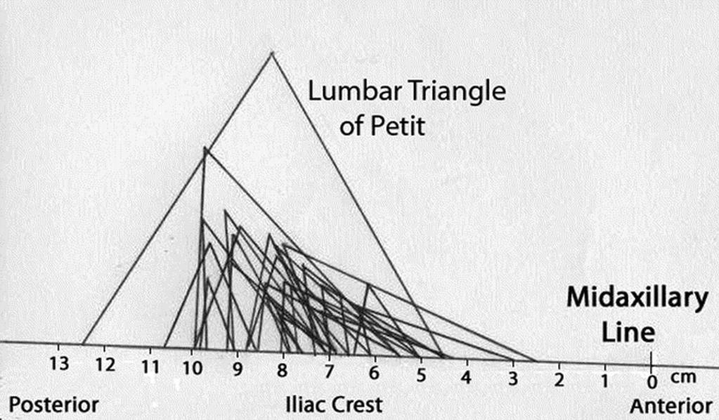 Comparison of sizes and shapes of the lumbar triangle of Petit and the distance of each posterior to the midaxillary line.