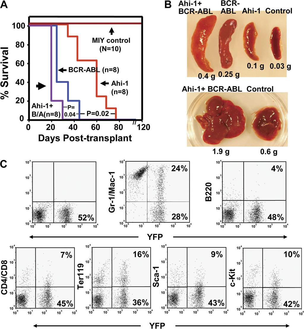 injected with either Ahi-1 or BCR-ABL transduced cells developed splenomegaly and hepatomegaly, with 50 90% of YFP + /Ahi-1 +, GFP + /BCR-ABL +, or both YFP + GFP + cells detectable in these tissues