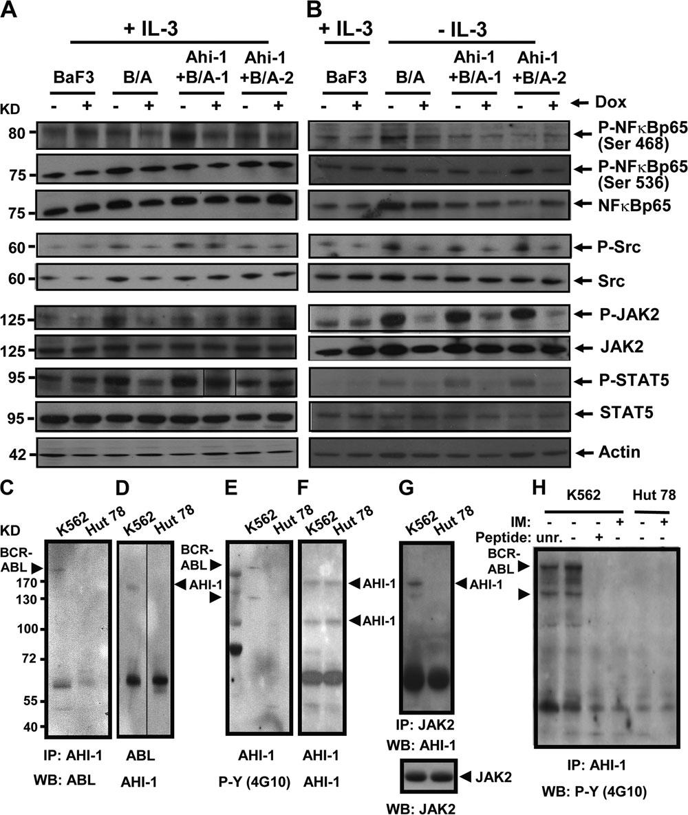 that Ahi-1 may play a regulatory role in mediation of BCR- ABL activity associated with enhanced activation of JAK2 and STAT5 through the IL-3 signaling pathway.