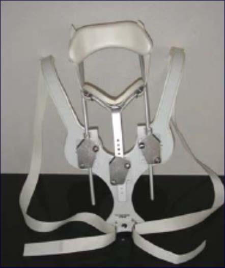 Non-operative Care Rigid collars Conventional collars offer little stability to