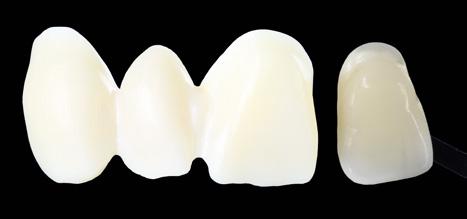 On bright zirconia frames, missing chroma can be balanced and on transparent frames value can be increased.