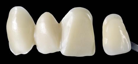 750 chroma dentine is coded according to the desired dentine shade (e. g. CD A3 for D A3).