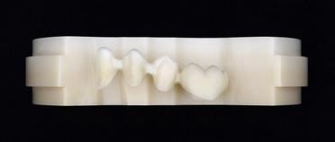 The dima Mill Zirconia ML material is available in various shade nuances. Find out more: www.kulzer.