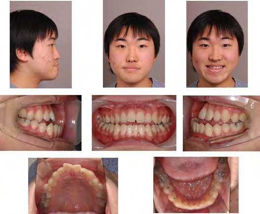 276 Orthodontics Basic Aspects and Clinical Considerations