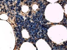 Cntrl Immunhistchemical staining with PAT-