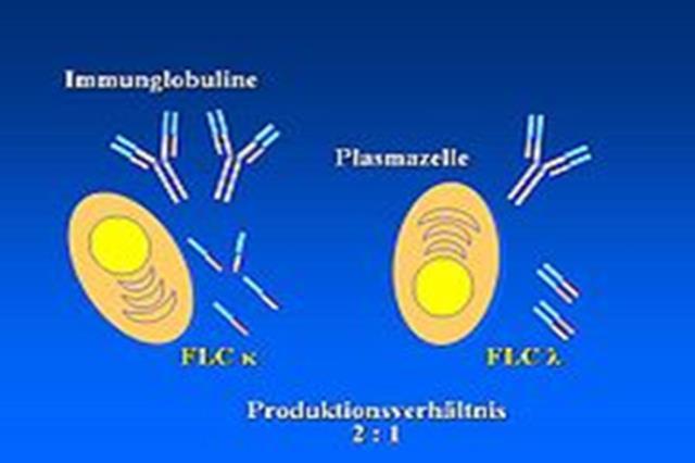 prteins) Abnrmal prteins in serum detected by
