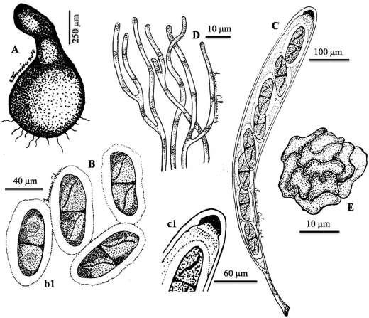 Fig. 3 Delitschia gigaspora var. pescanii. A: Pseudothecium. B: Mature ascospores, with germ slit. b1: Immature ascospore, with de Bary bubbles. C: Mature ascus. c1: Detail of the ascus apex.