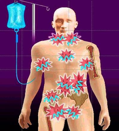 Immunotherapy - mechanism of