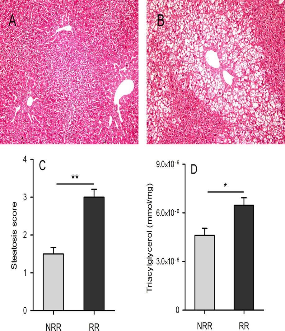 NAFLD AND MICROBIOTA Intestinal microbiota determines development of NAFLD in mice Non-Responder HFD 16 weeks Responder NRR RR Fecal transplantation NR-Recipient NRR