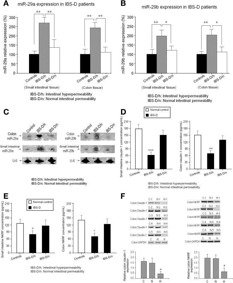 Increased intestinal permeability and mir-29 expression