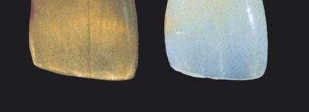 effect in the patient mouth + + Excellent VITA shade matching Perfect balance of translucency and opalescence of a monolithic Celtra Pressing Strength to rely on + + Exceptional flexural strength