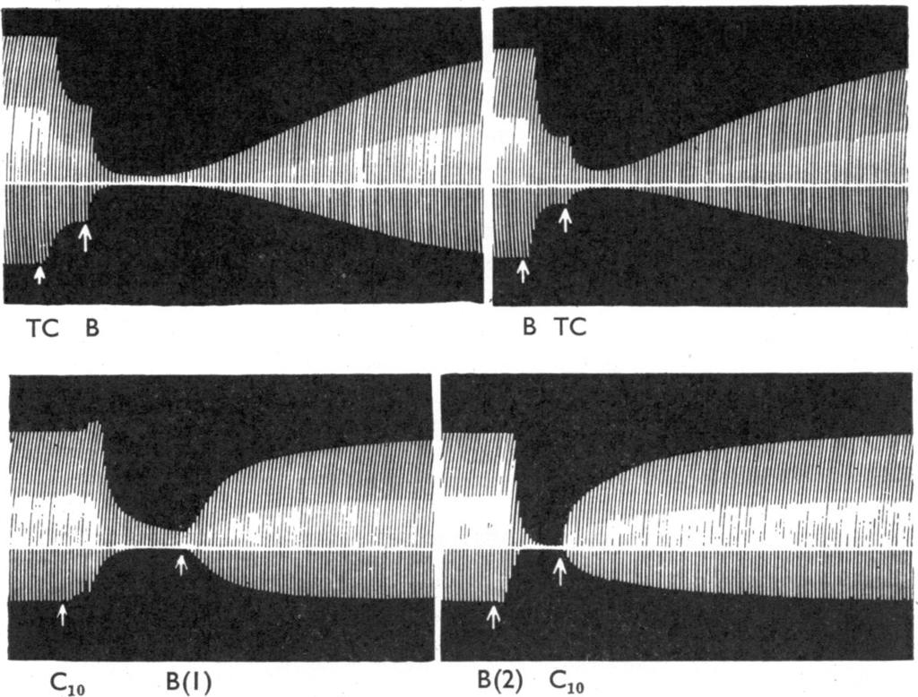 524 W. C. BOWMAN i II ii i' 'ii' cat 3.8 kg. Maximal twitches of b, the cat 2.9 tibialis kg. anterior muscles were elicited indirectly once every 10 sec. At TC B B TC TC, 0.4 mg. of tubocurarine.