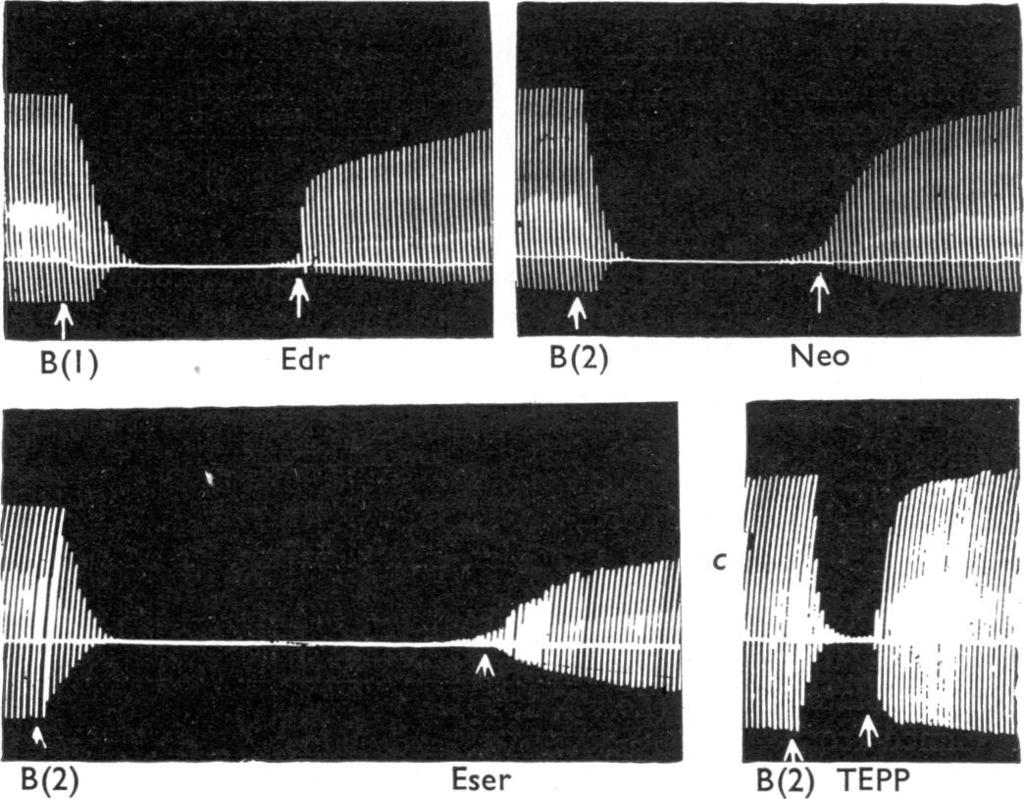Max,ximnal gastrocnemius muscle were elicited indirectly once every 10 ssec. At B(1) 0.4 mg. and at B(2) 0.5 mrg. of benzoquinonium. At Edr 0.3 mg., of edrophonium.
