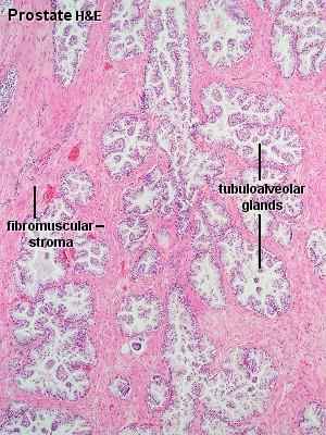The glands is surrounded by fibroelastic capsule rich in smooth muscle.septa form this capsule penetrate the gland and divided it into lobes.