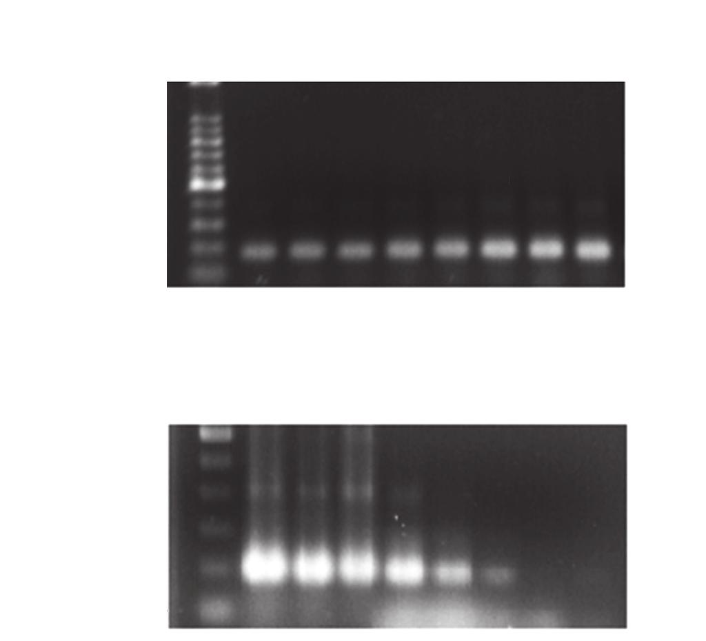 Gilber SR et al PCR for routine diagnosis of Trypanosoma cruzi Therefore, the technique was sensitive enough to detect a single parasite in 10mL of blood.