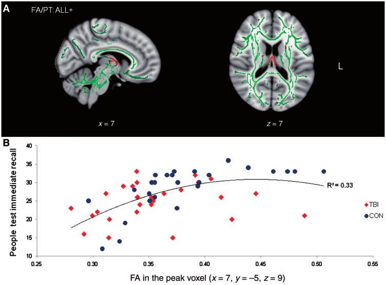 White matter and cognition in traumatic brain injury Brain 2011: 134; 449 463 457 The relationship between white matter structure and cognitive function Associative memory Across both patients and