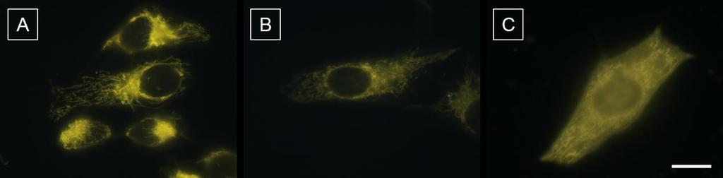 Fig. S8 Fluorescent images of HeLa cell stained with TPE-Py-NCS (5 μm) for 15min.