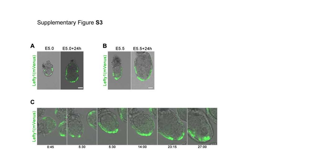 Supplementary information, Figure S3. Embryo autonomous establishment and migration of DVE in Lefty1(mVenus) embryos. Representative pictures of (A) E5.0 embryos (n=8 embryos) and (B) E5.