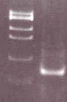 repeat of the rpot gene (Matsuoka et al, 2000). A total volume of 25 µl of PCR mixture was composed of DNA prepared from skin biopsy samples, Q-solution (Qiagen, Valencia, CA), 15 mm MgCl 2, 0.